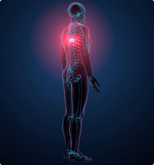 Musculoskeletal Pain & Inflammation