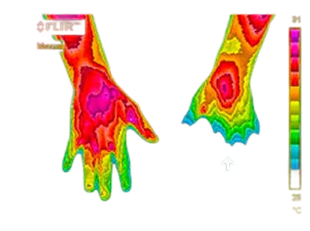 Before thermal image